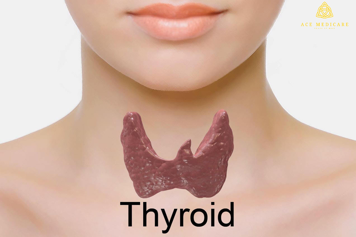 The Connection Between Diet and Thyroid Health: What You Need to Know